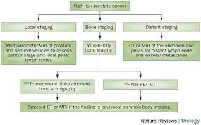 prostate cancer symptoms can include difficulty urinating, frequent urination, pain while urinating, and a diminished urine stream, but oftentimes there are no signs or symptoms. Imaging And Evaluation Of Patients With High Risk Prostate Cancer Nature Reviews Urology