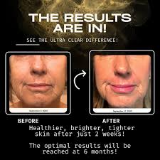 Beautiful memory of my sweet Jacob and adorable Bella pup ❤️‍🩹 Love you Jacob  Knudsen!