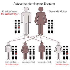 Chorea Huntington Wikipedia