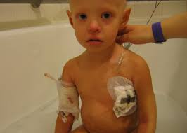 Donna's Cancer Story: Transplant, Part I