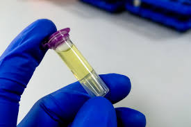 Image result for Cerebrospinal Fluid Color