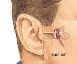 See full list on health.harvard.edu Perforated Eardrum Guide Causes Symptoms And Treatment Options
