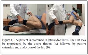 Image result for Snapping Hip