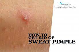 Instead, try these methods to get rid of pimples fast: How To Get Rid Of Sweat Pimple Blog Details Meditour Ppe Kit Face Mask Digital Thermometer