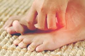 Image result for diabetic toes