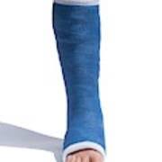 Image result for Short Leg Cast