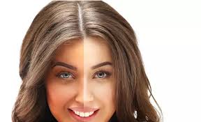 Skin Whitening Treatment Chandigarh