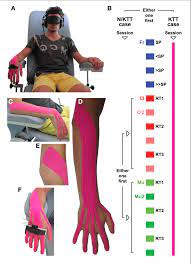 Kpu kabupaten mamuju provinsi sulawesi barat (sulbar) menetapkan jumlah daftar pemilih tetap (dpt) yang akan menyalurkan hak pilihnya di . A The Subject Is Seated On A Chair With Armrests Wearing An Download Scientific Diagram