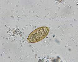 A helminth is a medical term for intestinal worms. Parasite Investigations Faeces Stool Ova Cysts Worms Giardiasis Amoebae Cryptosporidium Threadworm Enterobius