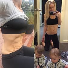 This Photo Shows That Loose Skin Is Normal After Giving Birth Even If You Have A Six Pack Loose Skin Loose Belly Post Baby Belly