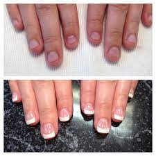 Before And After On A Nail Biter Nails Gel Nails Rings For Men