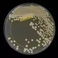 Image result for Buchnera candida