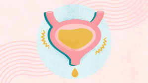 Image result for Urinary Incontinence