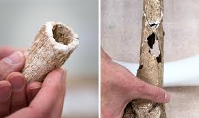Check spelling or type a new query. Civil War Battlefield Limb Pit Reveals Work Of Combat Surgeons Kpbs