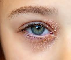 Image result for Blepharis bainesii