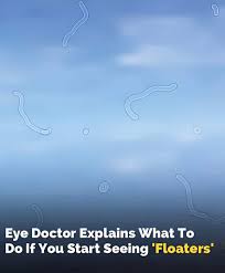 Image result for Floaters