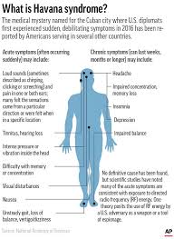 Everything we know about the strange symptoms plaguing u.s. Nig7d2xy2aetcm