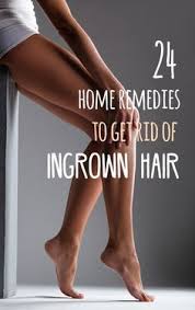 Ingrown Hair Appears Most Frequently In Legs Beard Area Bikini Area And Legs Find Out Some Of The Home Reme Ingrown Hair Remedies Ingrown Hair Hair Remedies