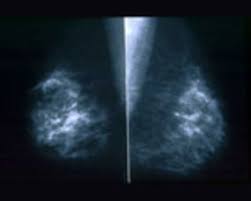 Sep 22, 2020 · it will take a few days, maybe even more than a week, for you to find out the results. How Doctors Interpret Mammograms