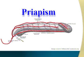 Image result for Priapism