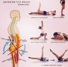 Yoga Daily Progress On Instagram Follow Weshanti Try These Exercises If You Suffer From Anterior Pelvic Tilt Scoliosis Exercises Exercise Massage Therapy