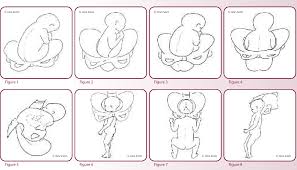 Image result for Breech Delivery