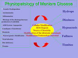 Venous Interventions In Meniere S Disease Aldo Bruno Md Gepos Clinic Ppt Video Online Download