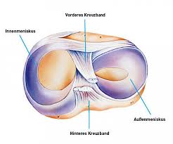 Maybe you would like to learn more about one of these? Kniegelenk Meniskusruptur Klinik Am Ring