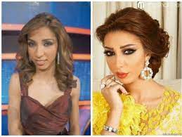 اعلن الفنان المصري &#8203;احمد فهمي&#8203; ØµÙˆØ± Ù‚Ø¯ÙŠÙ…Ø© Ù„Ø¯Ù†ÙŠØ§ Ø¨Ø·Ù…Ø© ØªÙƒØ´Ù Ø®Ø¶ÙˆØ¹Ù‡Ø§ Ù„Ù„ÙƒØ«ÙŠØ± Ù…Ù† Ø¹Ù…Ù„ÙŠØ§Øª Ø§Ù„ØªØ¬Ù…ÙŠÙ„ Ø´Ø§Ù‡Ø¯ Ø§Ù„ÙØ±Ù‚ Ø¯Ù†ÙŠØ§ Ø§Ù„ÙˆØ·Ù†
