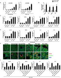 Check spelling or type a new query. Pinealectomy Or Light Exposure Exacerbates Biliary Damage And Liver Fibrosis In Cholestatic Rats Through Decreased Melatonin Synthesis Sciencedirect
