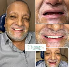 Hi Dent Dr. Ashraf Kamel (@hi.dent.egy) · Instagram 照片和视频