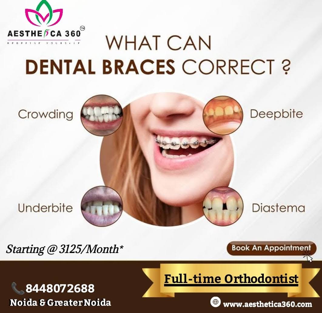 Dental Braces product image