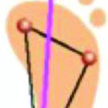 Image result for Probe-to-Bone Test