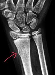 Maybe you would like to learn more about one of these? Pin On X Rays