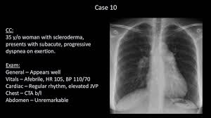 Image result for Chest XRay Interpretation