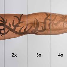 Picosure & picoway are the safest, most effective tattoo removal lasers available; Tattoo Removal Best Laser Tattoo Removal Treatments Elc