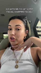 PRP Facial (Vampire Facial) Transformation in 5 Days!