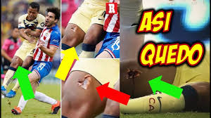 Analysis dos santos is back from his ankle issue after missing the last two matches completely. Asi Quedo La Pierna De Giovani Dos Santos Tras Terrible Lesion En El Clasico Ante Chivas Youtube