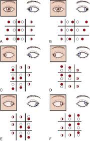 Neuro Ophthalmology Ocular Motor System Neupsy Key