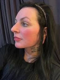 Hello, does anyone have the link to the WhatsApp group for Dr. Ozan Erol? I  am scheduling a primary Rhinoplasty with him in November. Also if anyone  has any useful information on