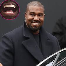 Kanye West Gets $850K Titanium Grill Inspired by James Bond Villain