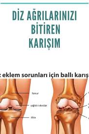 Diz Agrilarinizi Bitiren Karisim 2020 Saglik Saglik Urunleri Formda Kal