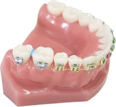 What can you eat with spacers. Separators Amanda Lawrence