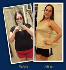 Gastric sleeve is not for everybody who is overweight, but if you're severely obese with another medical condition gastric sleeve — also known as laparoscopic sleeve gastrectomy — helps patients lose weight by removing. Revisional Surgery