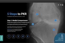 Check spelling or type a new query. Recognise The 5 Steps To Identify Your Pkr Patients