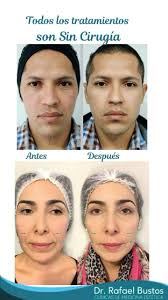 Dr. Rafael Bustos Clínicas de Medicina Estética te ofrece una variedad de  tratamientos no invasivos para ayudarte a alcanzar tus objetivos., Nuestros  tratamientos no invasivos utilizan tecnología ...
