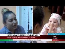 Kedi Miyavlamasi Sendromu Hastaligi Olan Zeynep Bebek Youtube