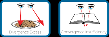 Image result for artistic divergence eyeballs