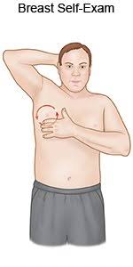 Men diagnosed with male breast cancer at an early stage have a good chance for a cure. Male Breast Self Exam What You Need To Know