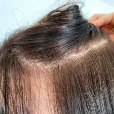 Wenn ja wie wendet man es an und wie lange ist die einwirkungszeit? Hellere Haare Ohne Blondierung Frag Mutti